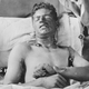 Illustration for article titled How A Notorious Chemical Weapon Led To The Invention Of Chemotherapy